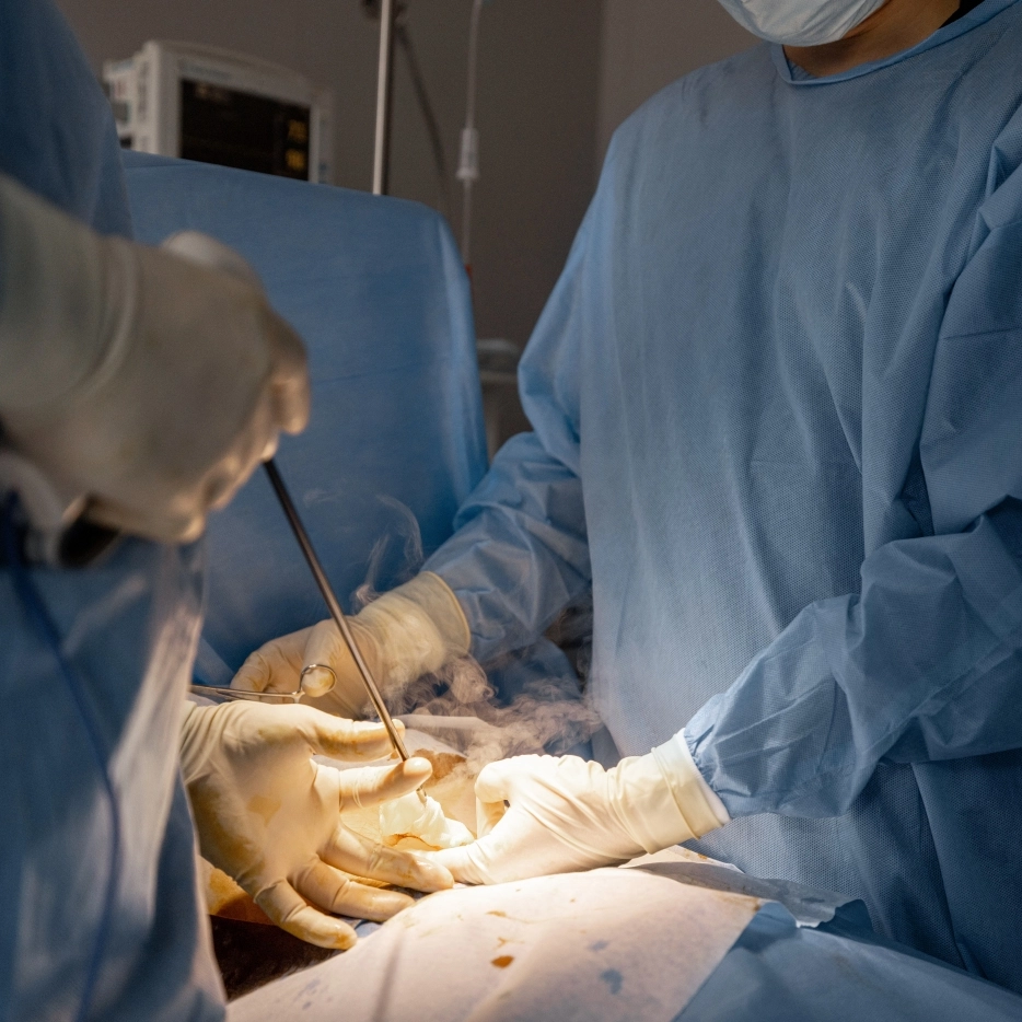 Surgical Smoke Management