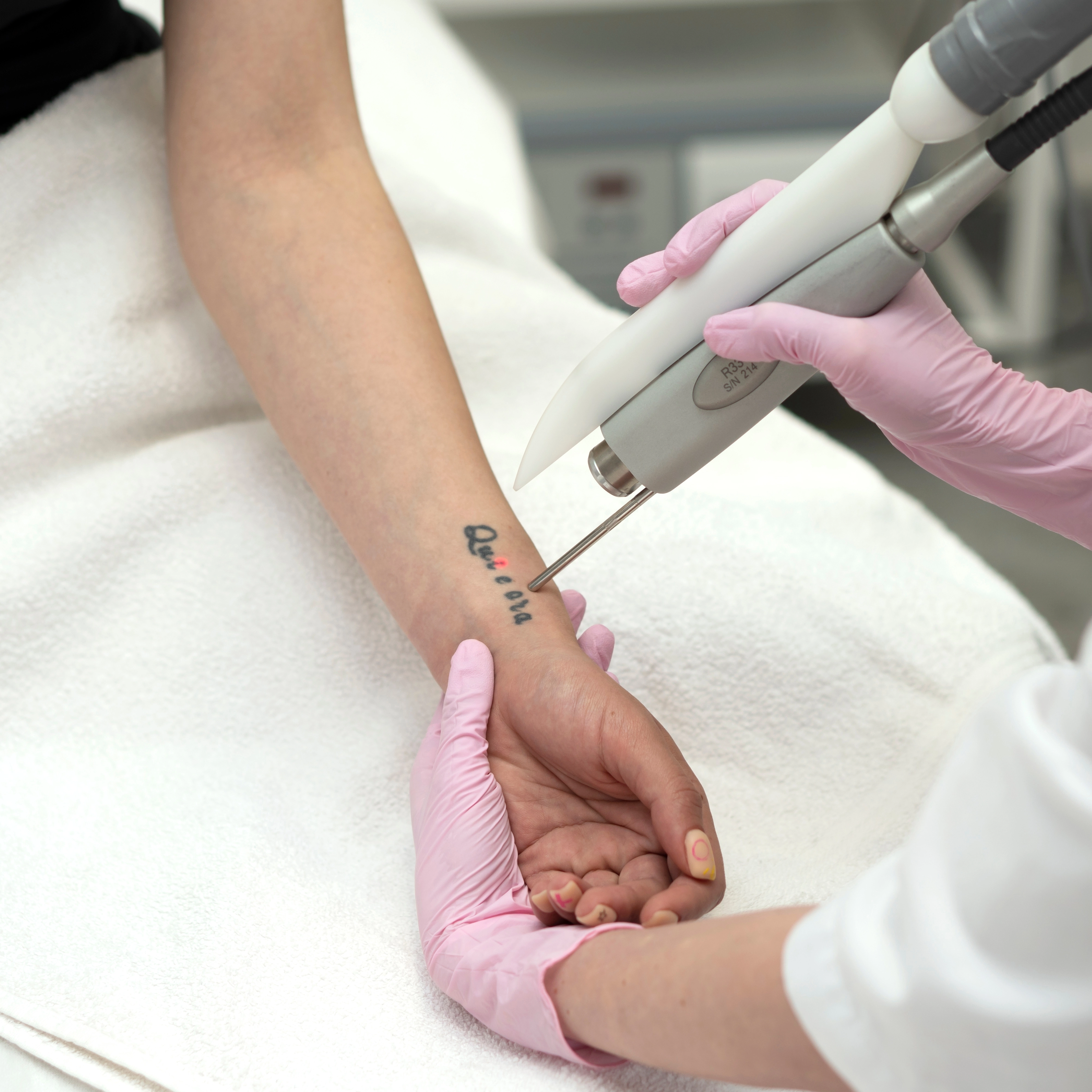 Tattoo Removal Smoke Management